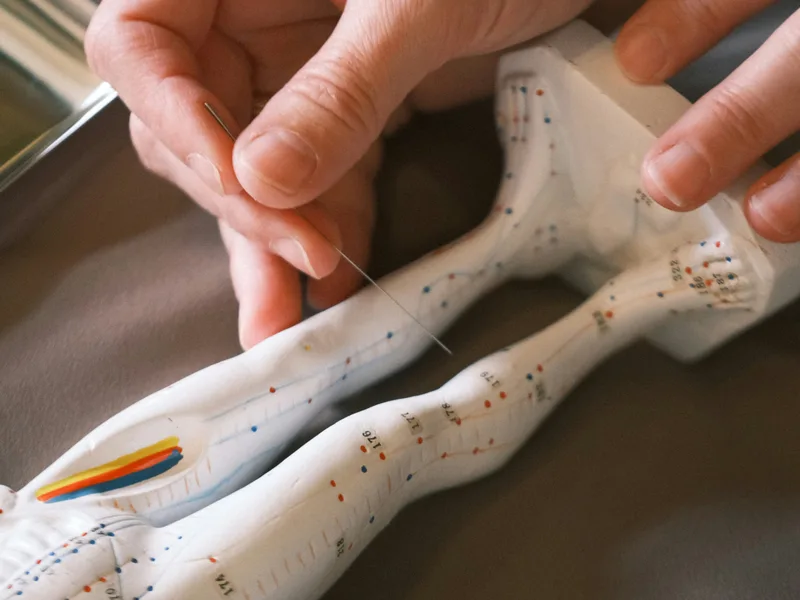 Acupuncture at Total Balance Chiropractic in Chicago