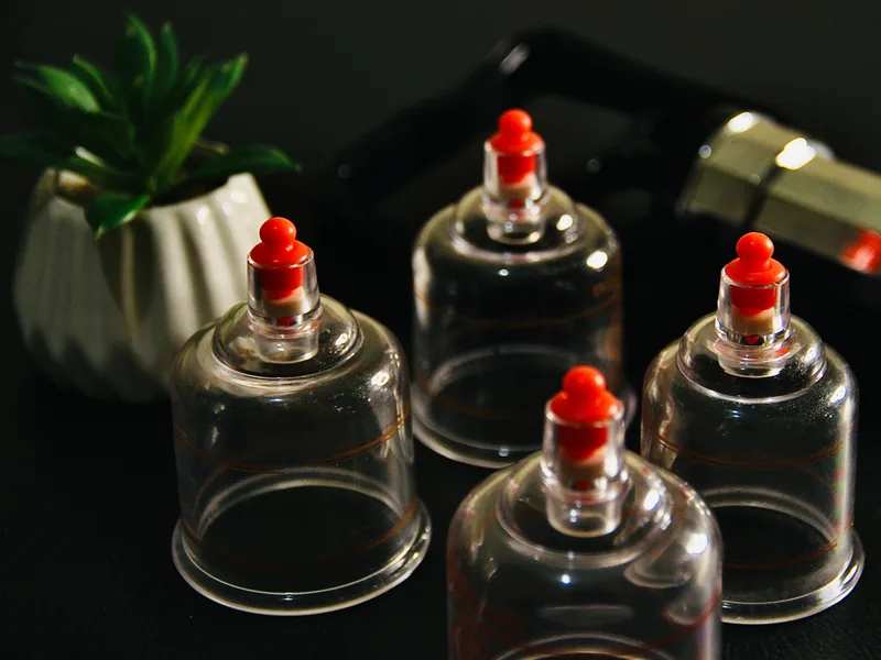 How Cupping Therapy works at Total Balance Chiropractic