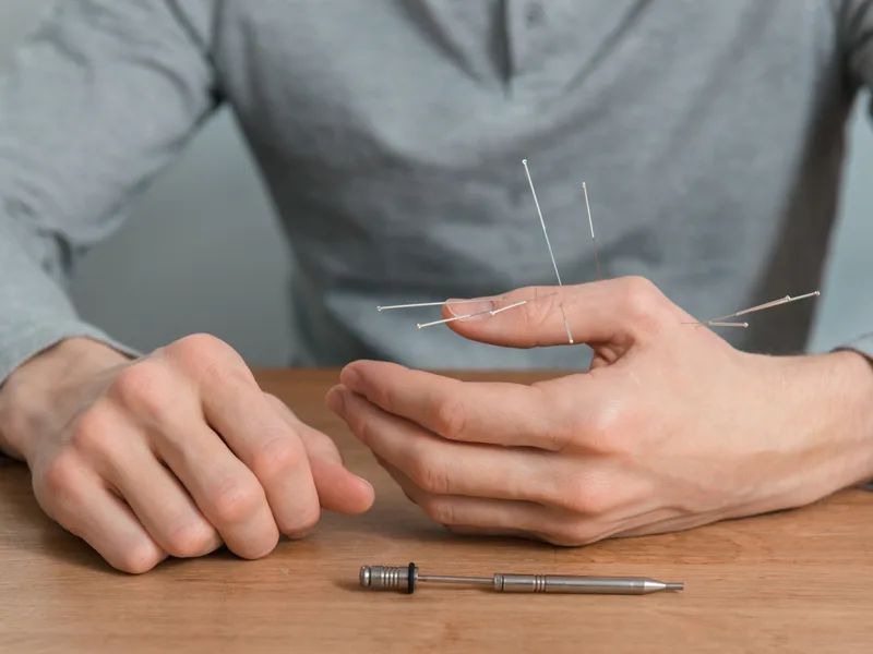 Dry Needling at Total Balance Chiropractic in Chicago