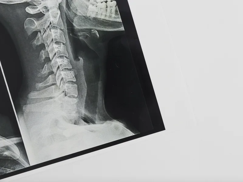 X-Rays at Total Balance Chiropractic in Chicago